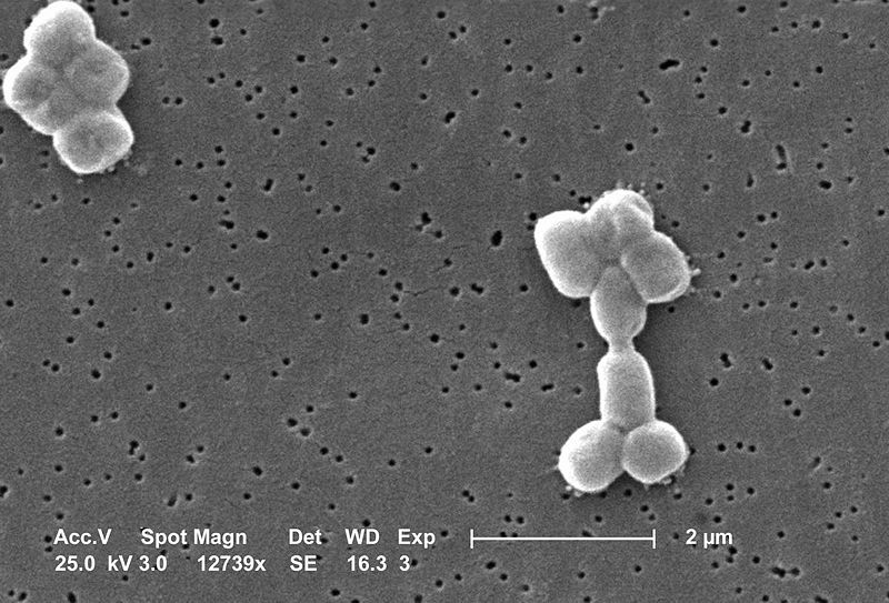an image of bacteria of the Acinetobacter Baumannii bacteria